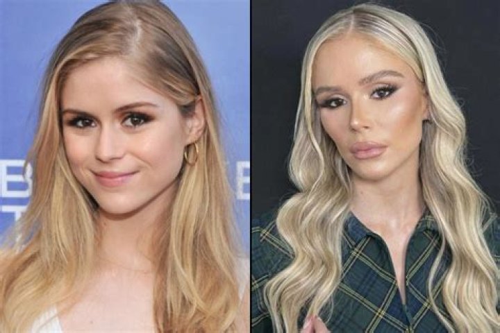 Alisha Lehmann No Makeup 2024 Plastic Surgery