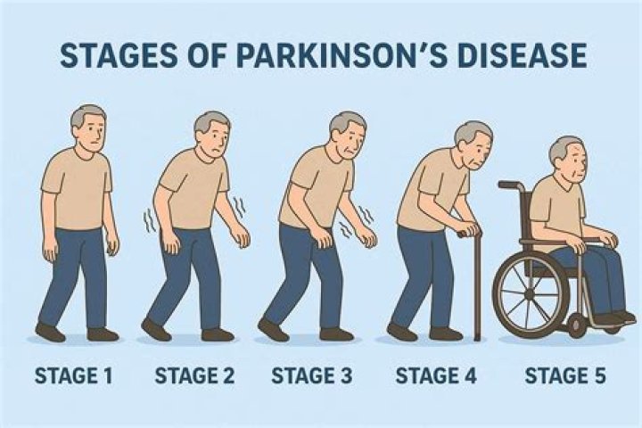 Exploring The Impact Of Paul Gosar's Illness On Parkinson Disability And Health